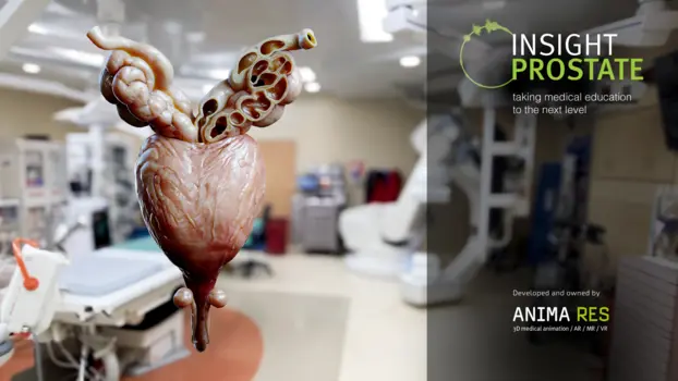 Insight Prostate